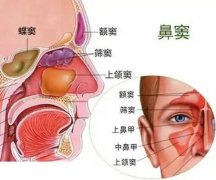 【全國愛鼻日】孩子出現(xiàn)這些癥狀，警惕鼻竇炎！